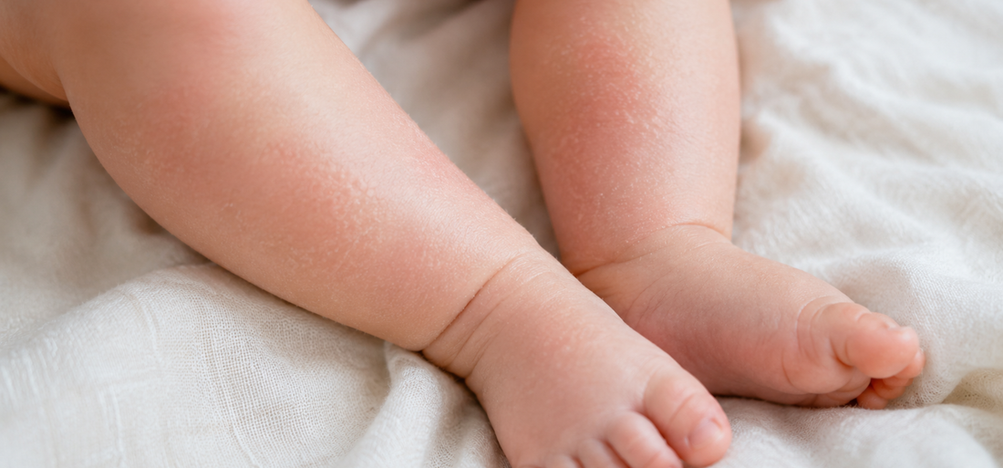 Pielea sensibilă a bebelușului — Tot ce trebuie să știi ca părinte, explicat de un dermatolog